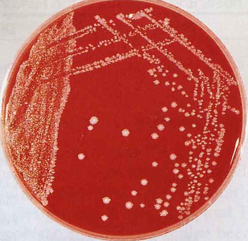 патогенные бактерии Pasteurella